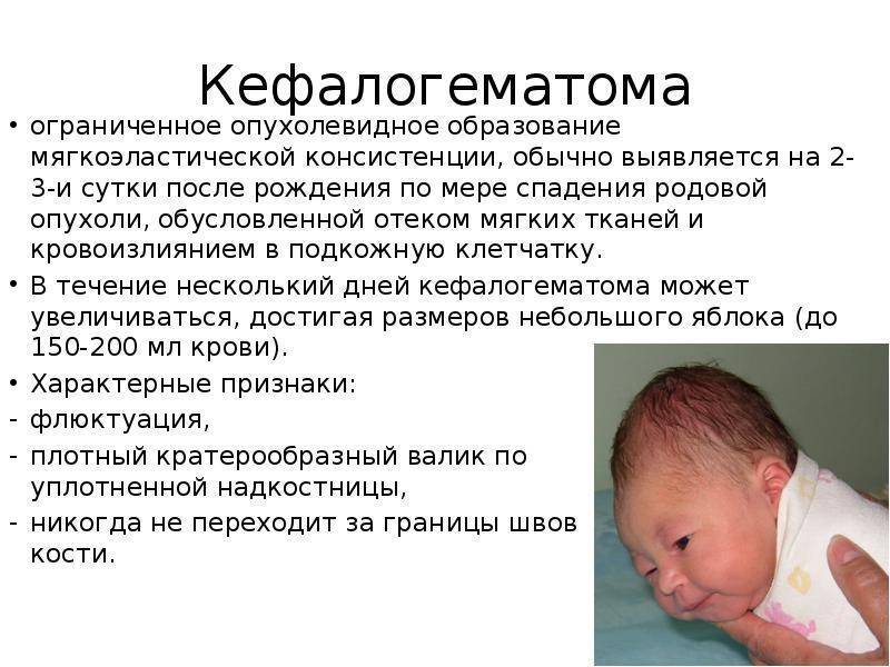 Гематома у новорожденного на голове после родов: последствия, причины и лечение