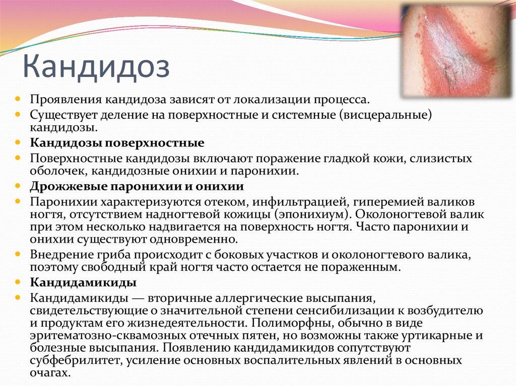 Грибковые заболевания кожи у детей