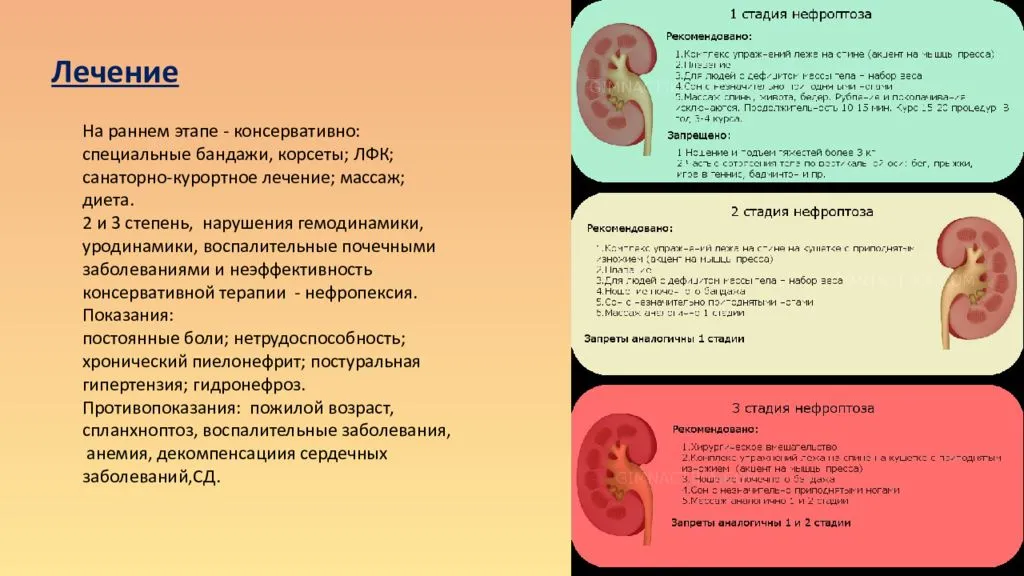 Гидронефроз почек у новорожденных — причины, симптомы, лечение