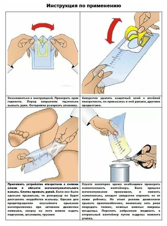 Как правильно собрать анализ мочи у новорожденного