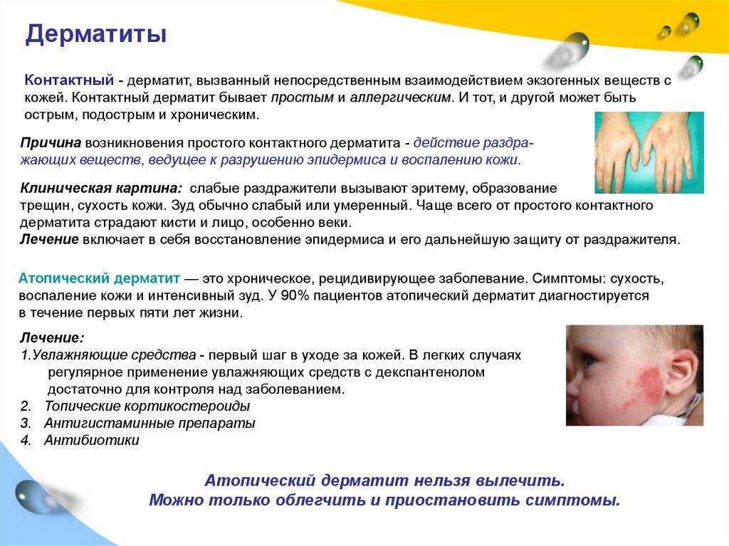 Что такое дерматит у ребёнка: причины патологии, симптомы и как выглядит атопическая стадия, методы лечения