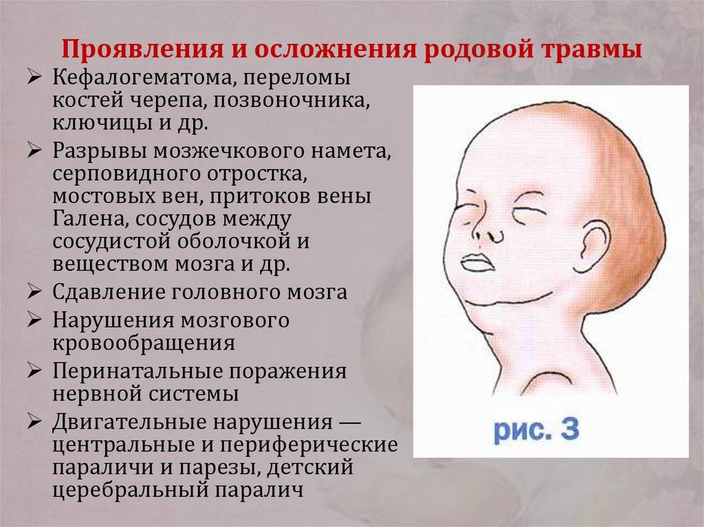Перелом теменной кости у грудного ребенка: лечение, первая помощь, последствия, симптомы и признаки