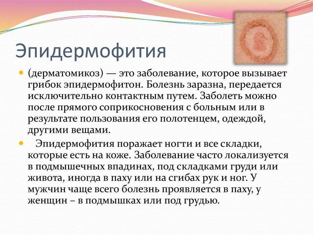 Грибковые заболевания у детей: причины, виды, диагностика и лечение