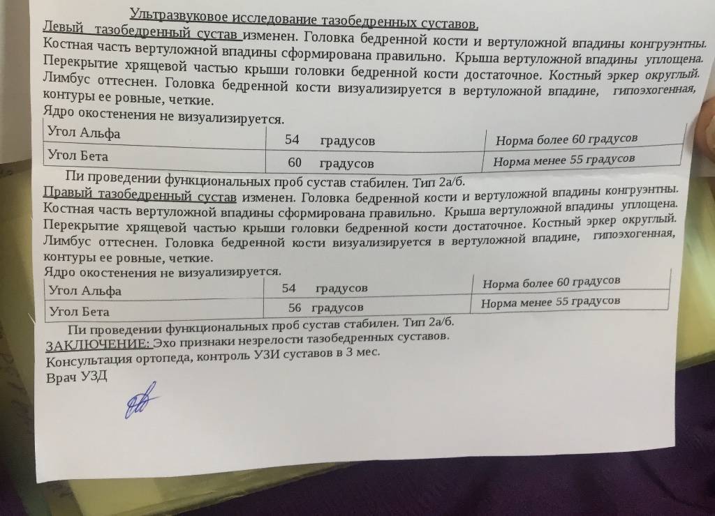 Что показывает узи тазобедренных суставов у грудничков?