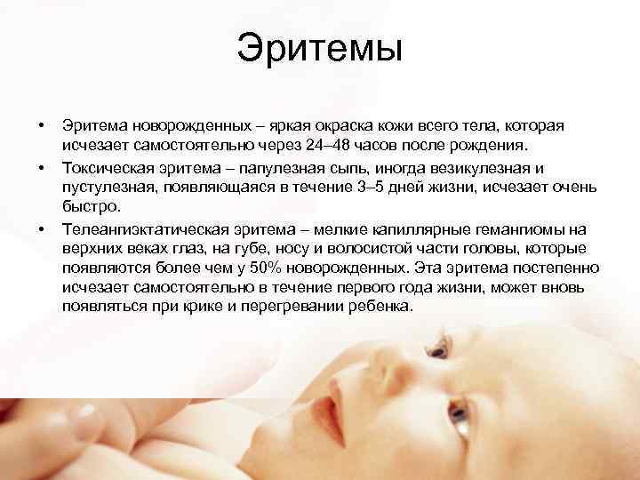 Токсическая эритема новорожденных: что это такое, от чего возникает, чем отличается от физиологической эритемы и как лечить заболевание? - медицинская энциклопедия