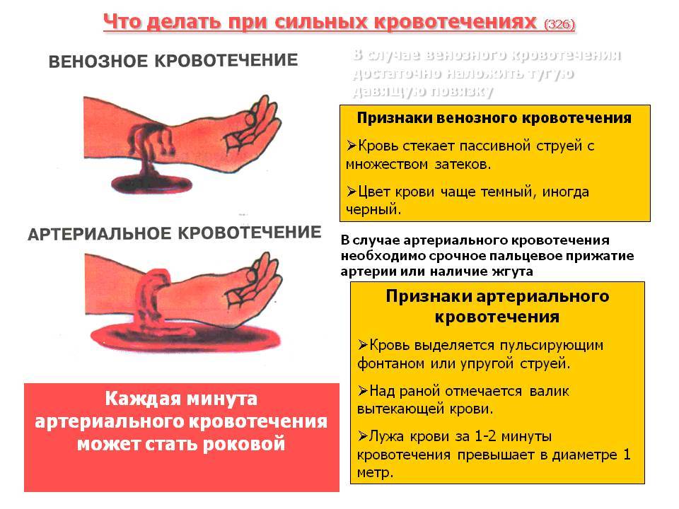 Кровотечение после месячных: причины, симптомы, виды и способы лечения