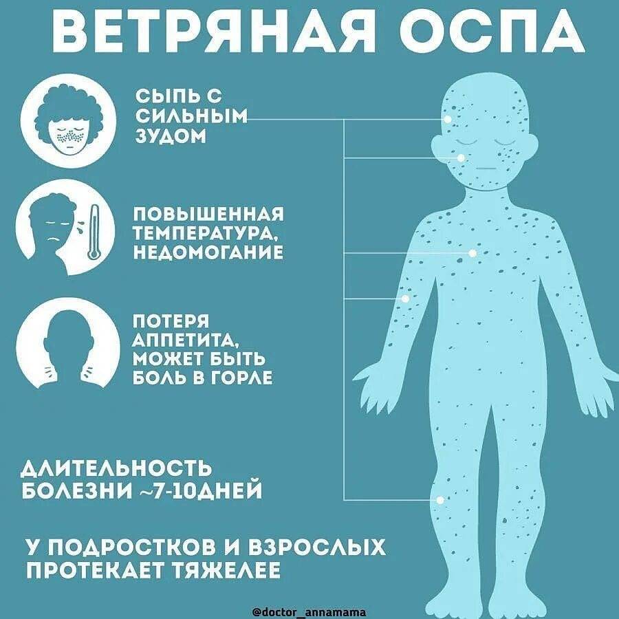 Ветрянка (ветряная оспа) у детей: симптомы, лечение, инкубационный период