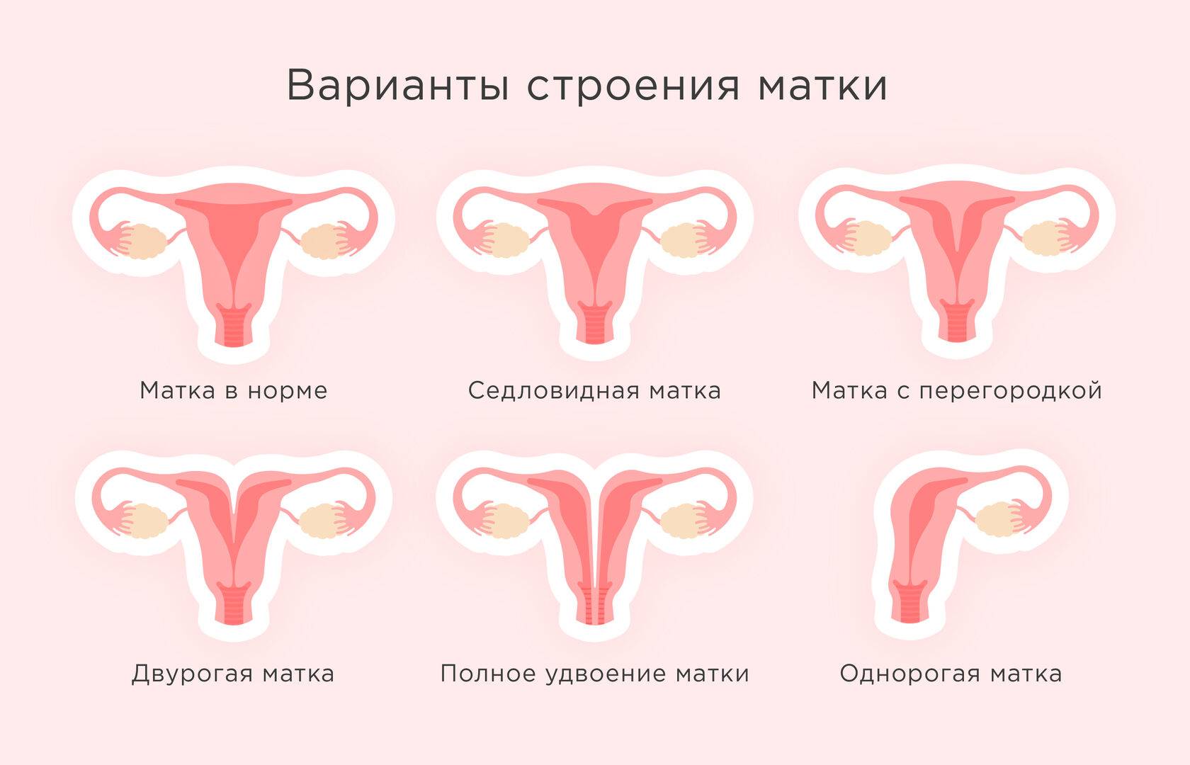 Седловидная матка | eurolab | гинекология
