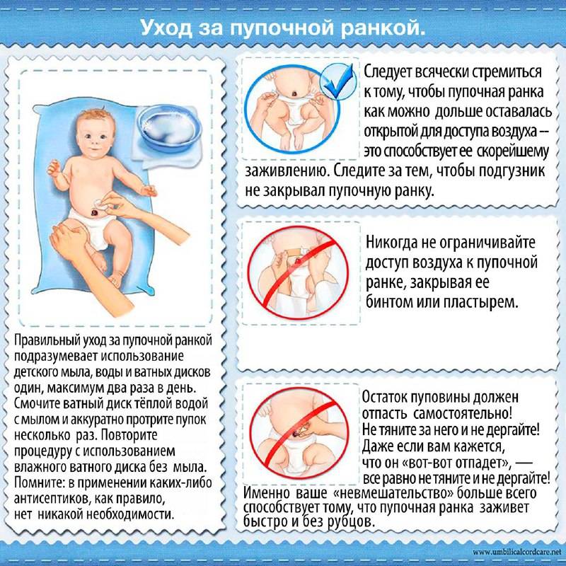 Как обрабатывать пупок новорожденного с прищепкой и без нее