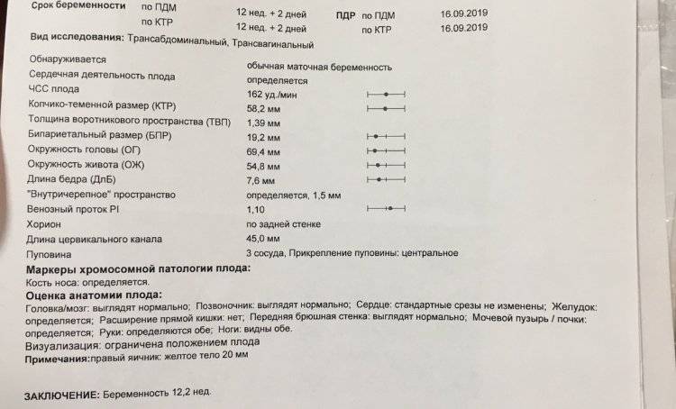У плода гипоплазия носовой кости: что это значит, какие нормы с 12 недели беременности в таблице?
