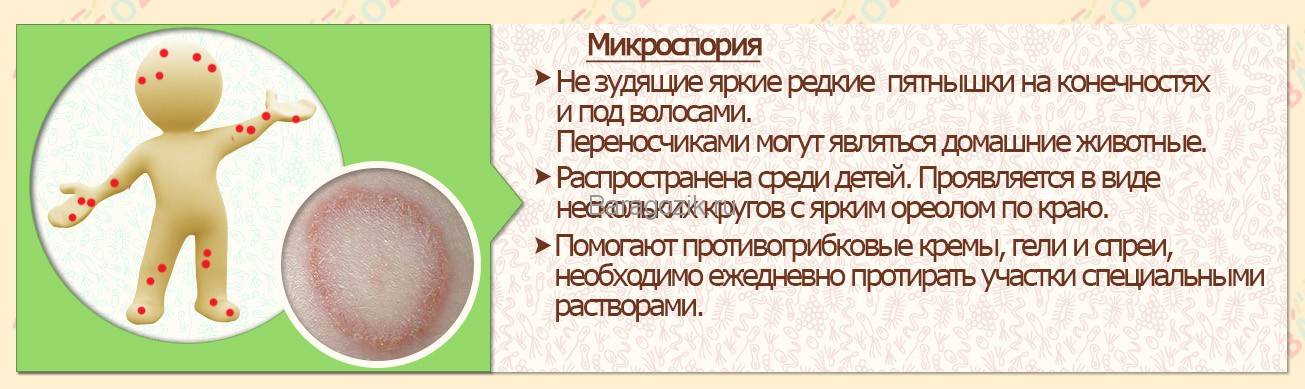 Шершавая кожа у ребенка: причины, внешние и внутренние, что делать