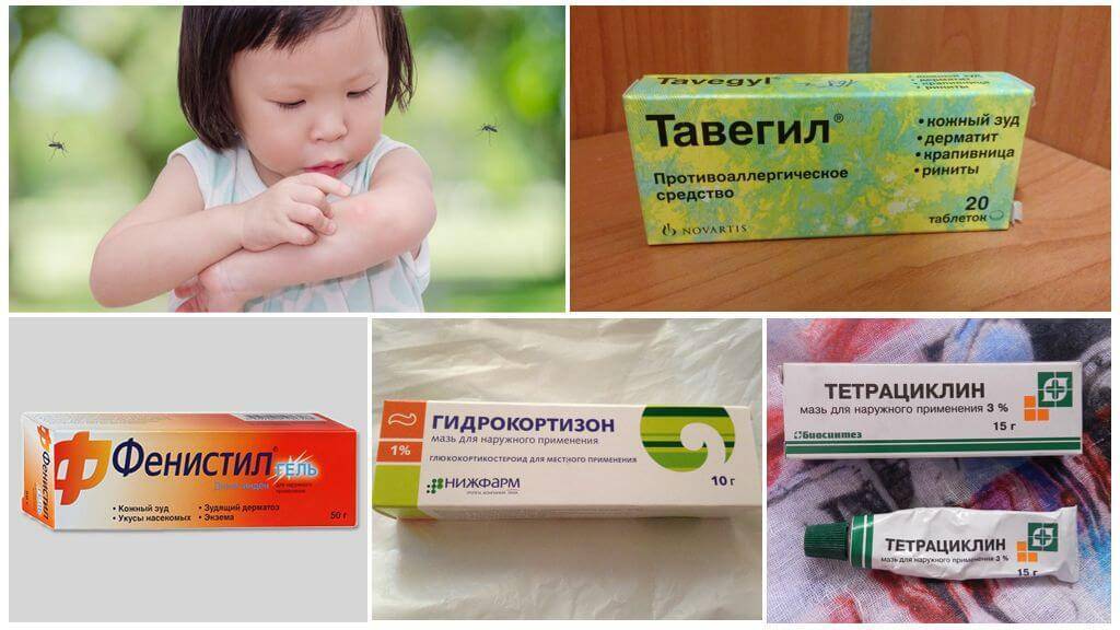Что делать, если ребенка укусил комар: чем лечить опухоль и покраснение, как снять зуд?