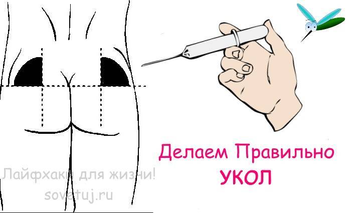 Как правильно колоть уколы в ягодицу самостоятельно самому себе и другим