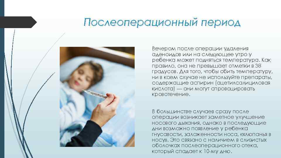 Удаление аденоидов