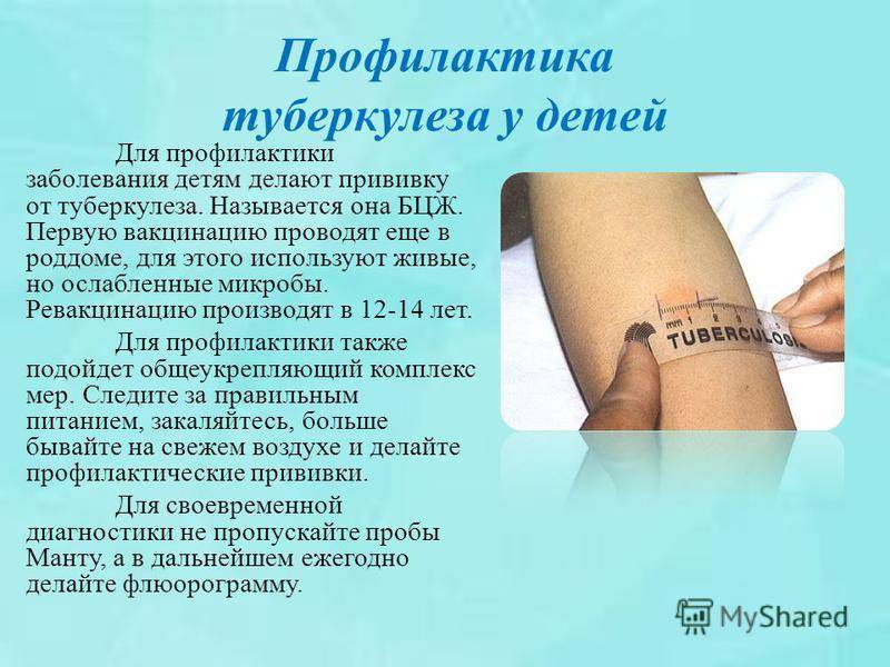 Новый санпин по профилактике туберкулеза – 2021. правда ли, что обязательные пробы манту для школ и детских садов отменили?