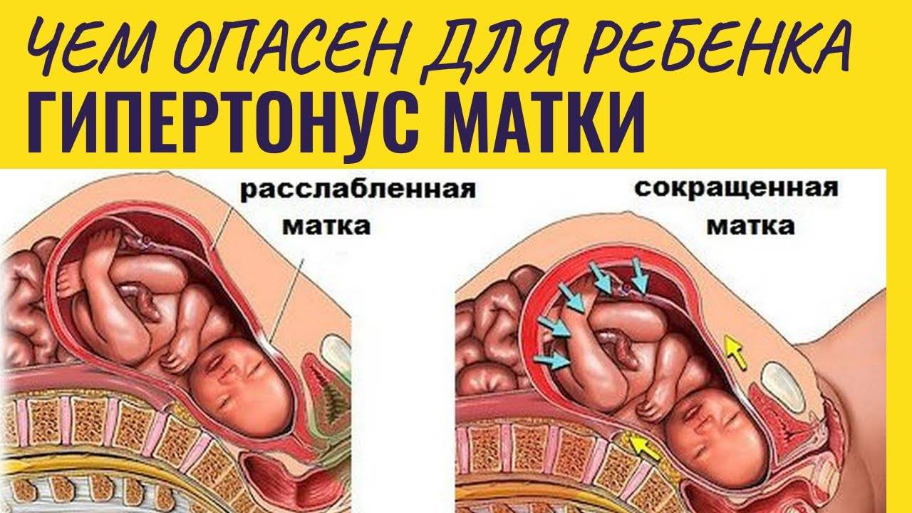 40 неделя беременности что происходит с плодом и что чувствует женщина подготовка к родам