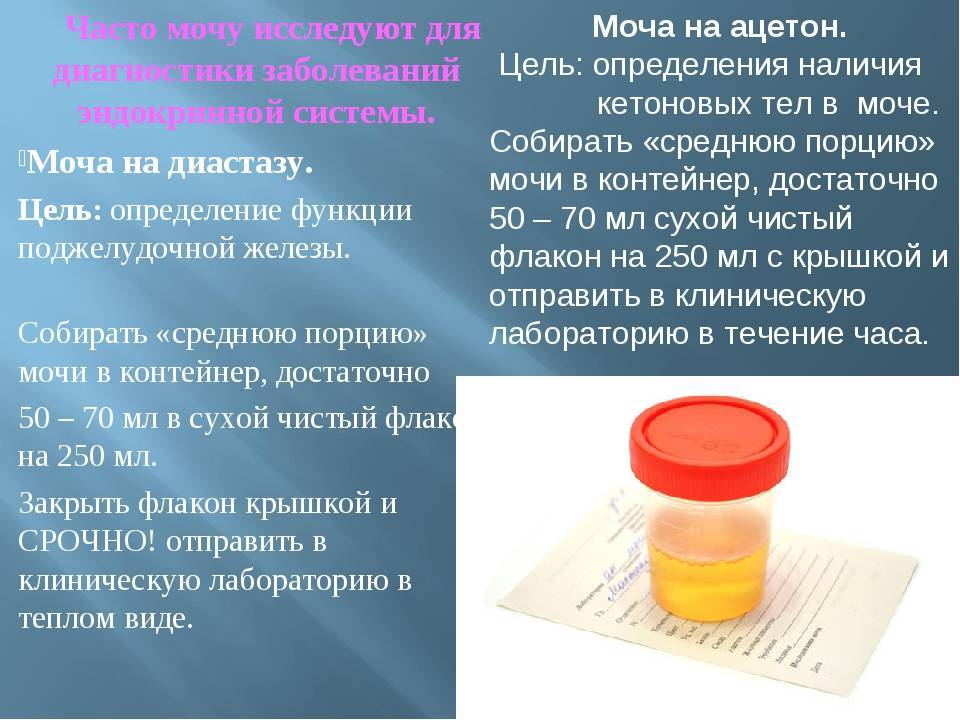 Диастаза мочи: норма у детей, сбор биоматериал для анализа у малышей разного возраста