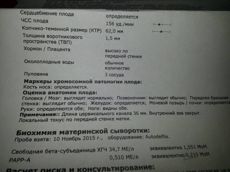 Когда на узи видно эмбрион: исследование в 5-6 недель беременности