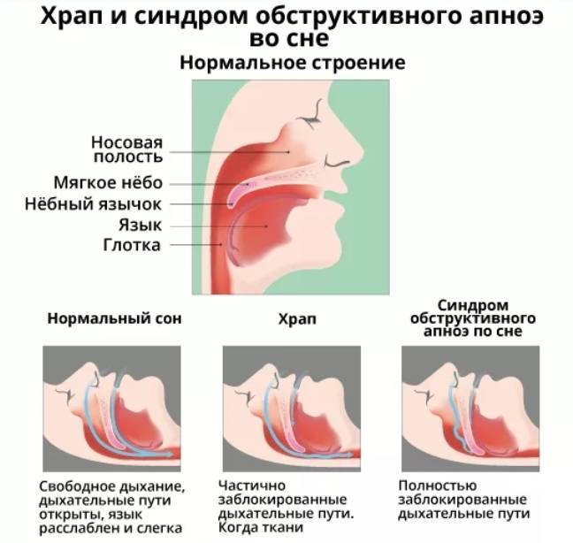 Ребенок храпит во сне соплей нет