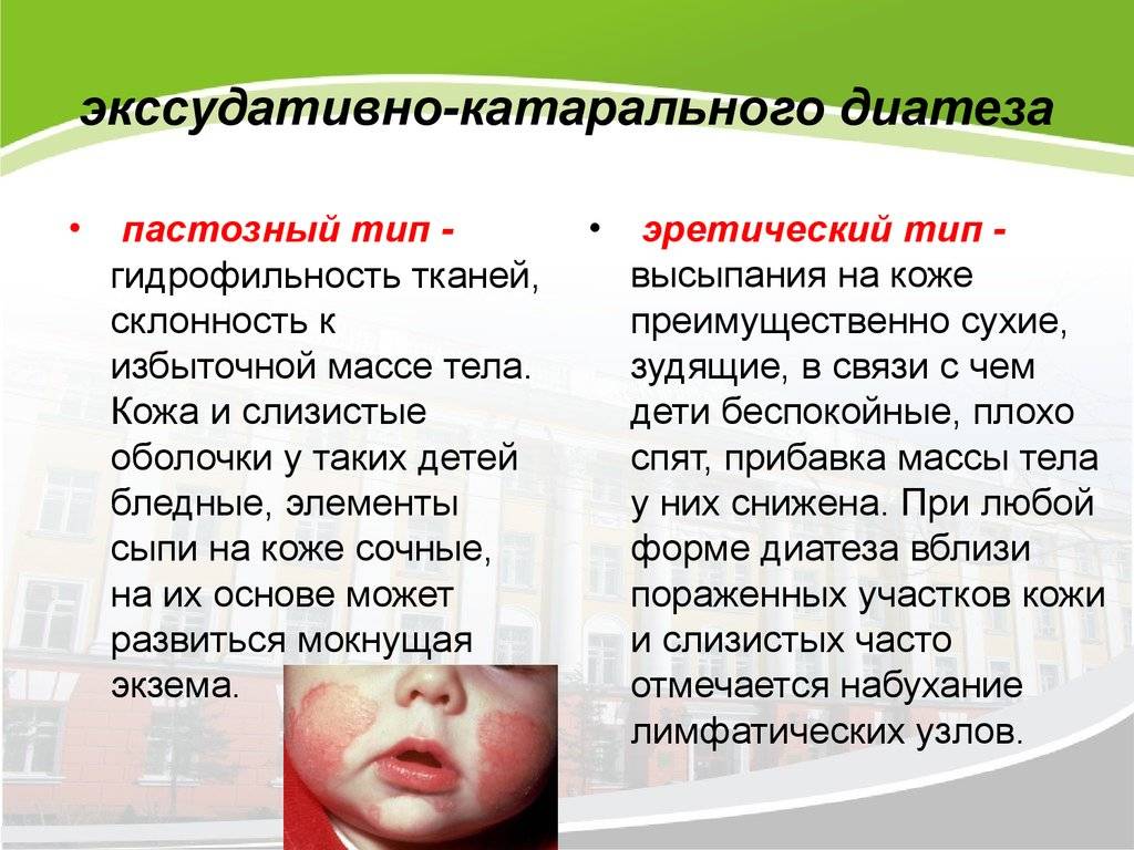 Аллергия на собаку у ребенка