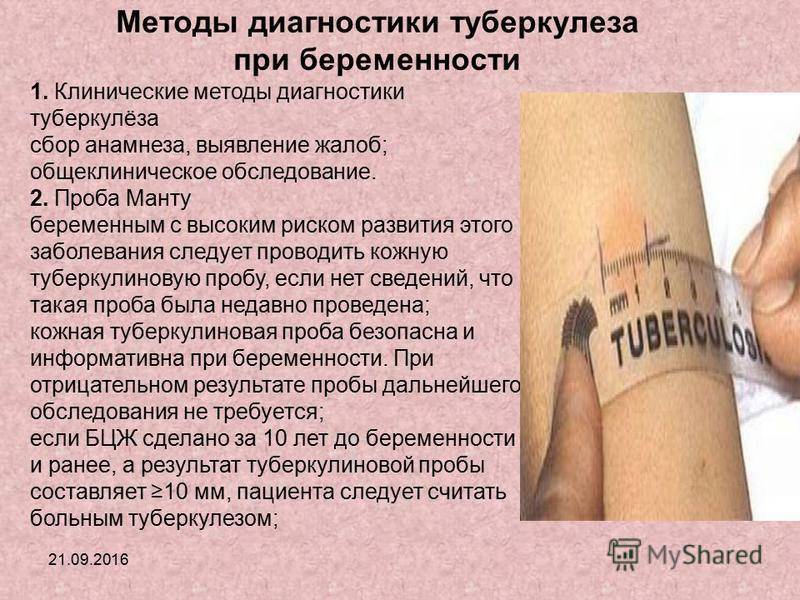 Можно ли делать манту, если ребенок болеет: влияние на результаты
