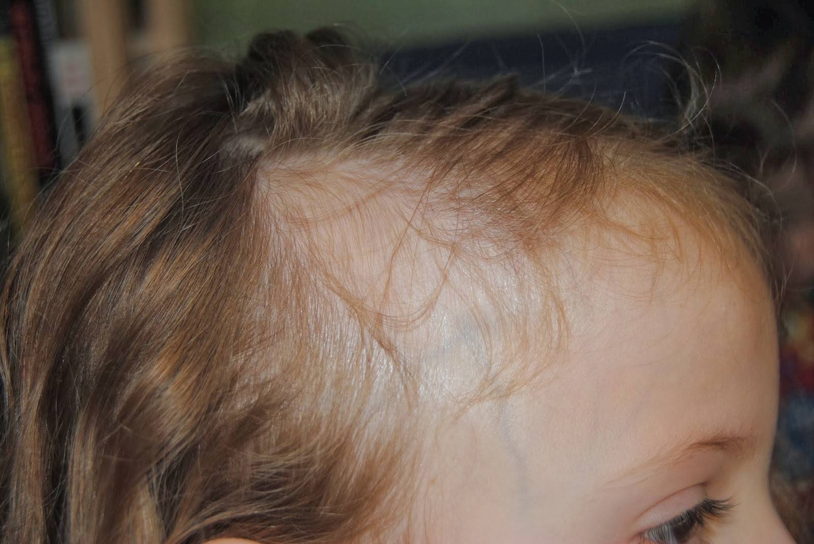 Какие витамины необходимы для нормального роста и здорового состояния волос у детей?