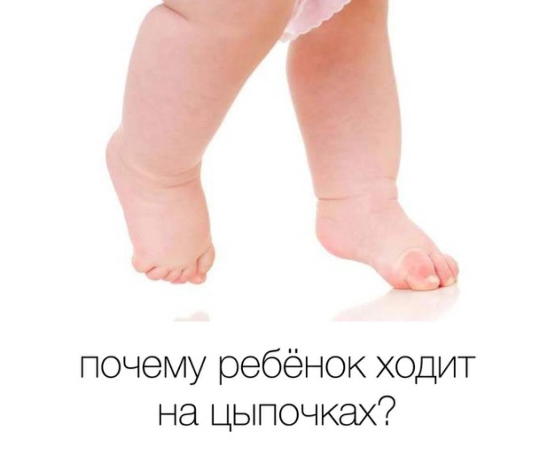 Ребенок ходит на носочках: почему так бывает и что с этим делать