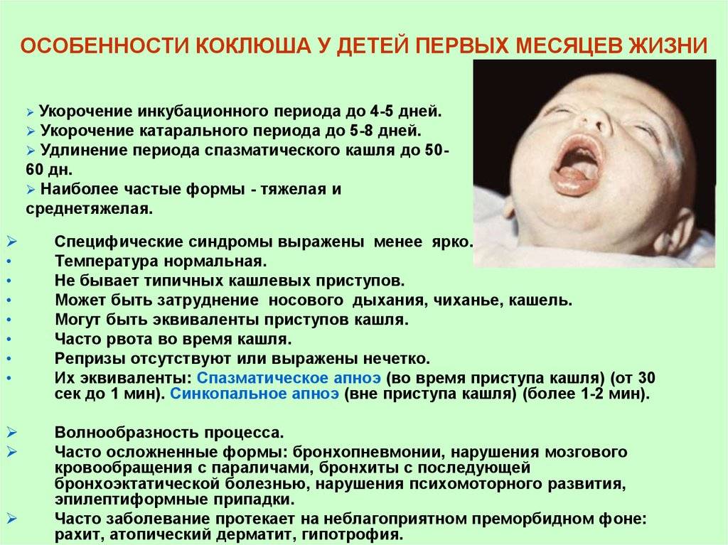 Коклюш у детей: симптомы, лечение, как заражаются, формы, возможные осложнения, профилактика