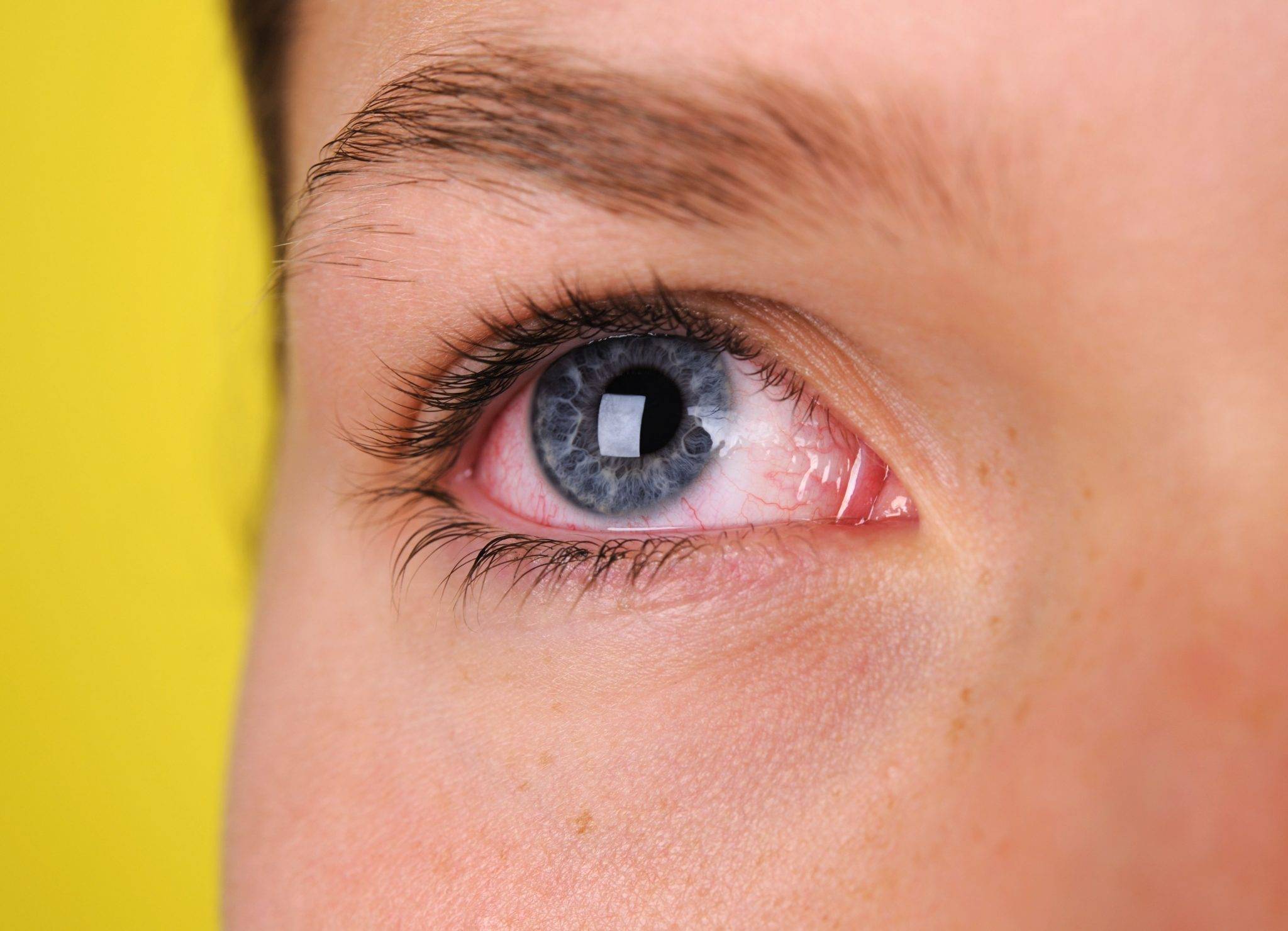 Красные глаза у ребенка: причины, симптоматика и методы лечения - "здоровое око"