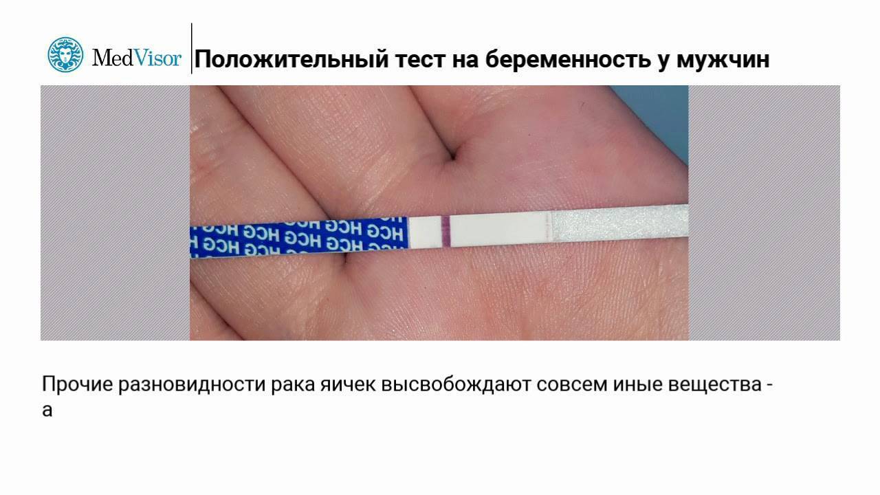 Как выглядит положительный тест на беременность и когда следует идти к гинекологу?