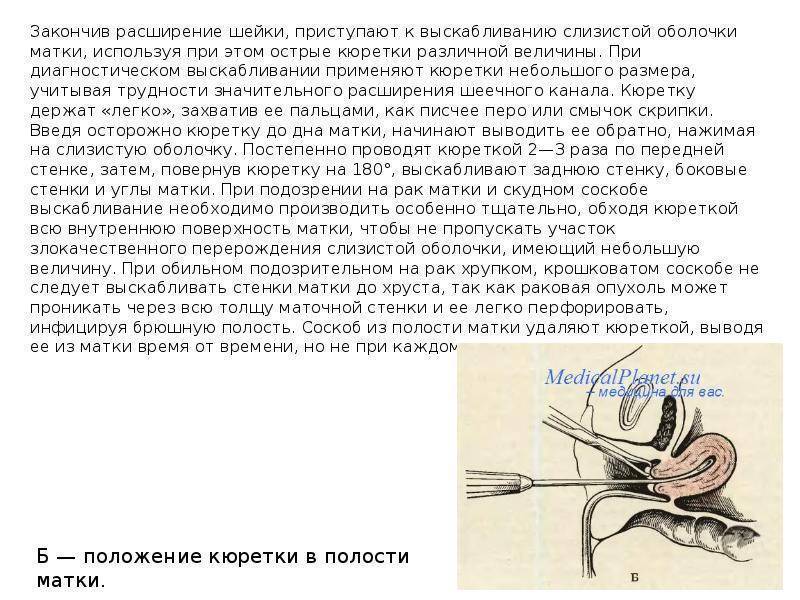 Можно ли заниматься сексом до и после кольпоскопии?
