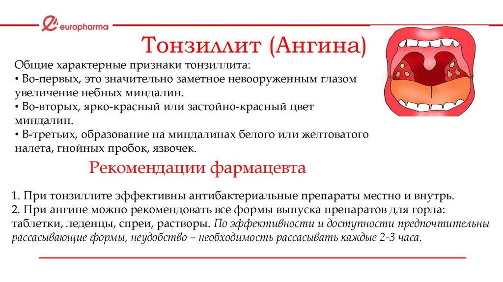 Герпесная ангина у детей: лечение, симптомы с фото горла и сыпи, подбор антибиотиков