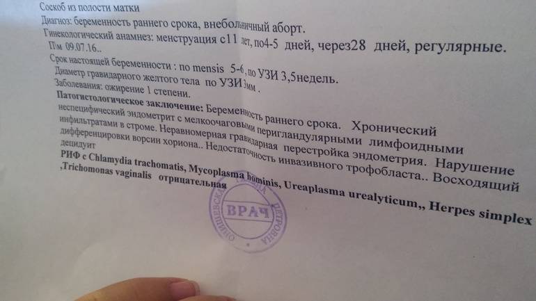 Часто задаваемые вопросы по аборту - отвечает гинеколог