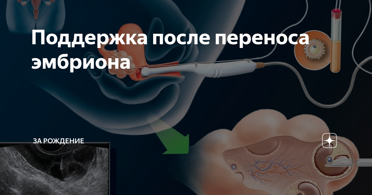 Имплантация эмбриона после эко: признаки, сроки, ощущения