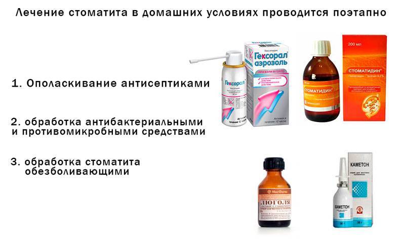 Лекарство от стоматита для детей до года и старше: мази, гели, спреи, растворы и таблетки