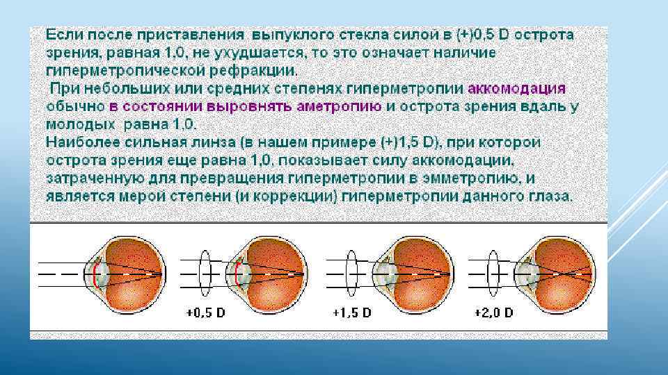 Дальнозоркость у детей