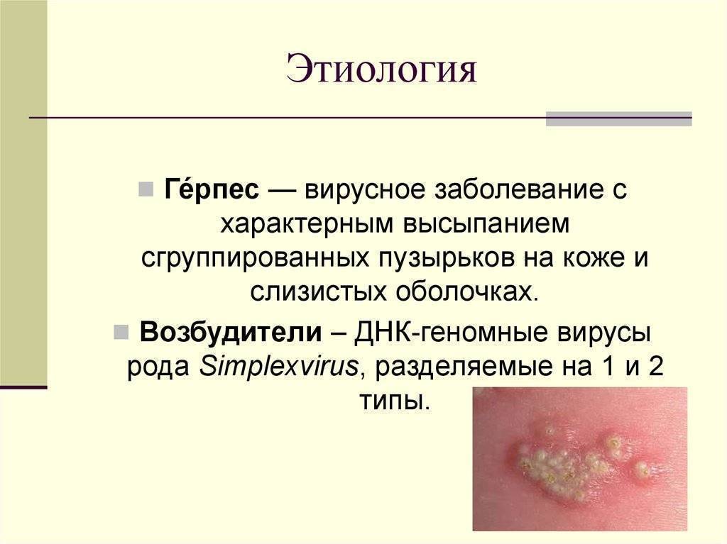 Герпес у грудничка: причины, симптомы, лечение у новорождённых