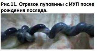 Когда можно подвязывать живот пеленкой и нужно ли перетягивать его сразу после родов?
