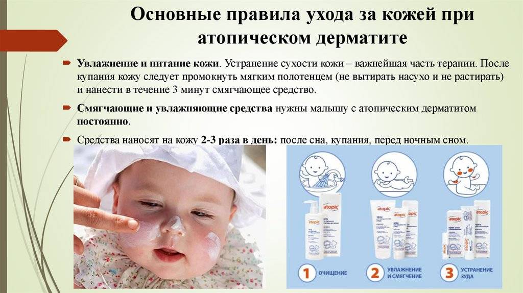 Аллергия у грудничков, как выглядит, симптомы, причины, какие лекарства можно и что исключить из рациона - ezavi.ru