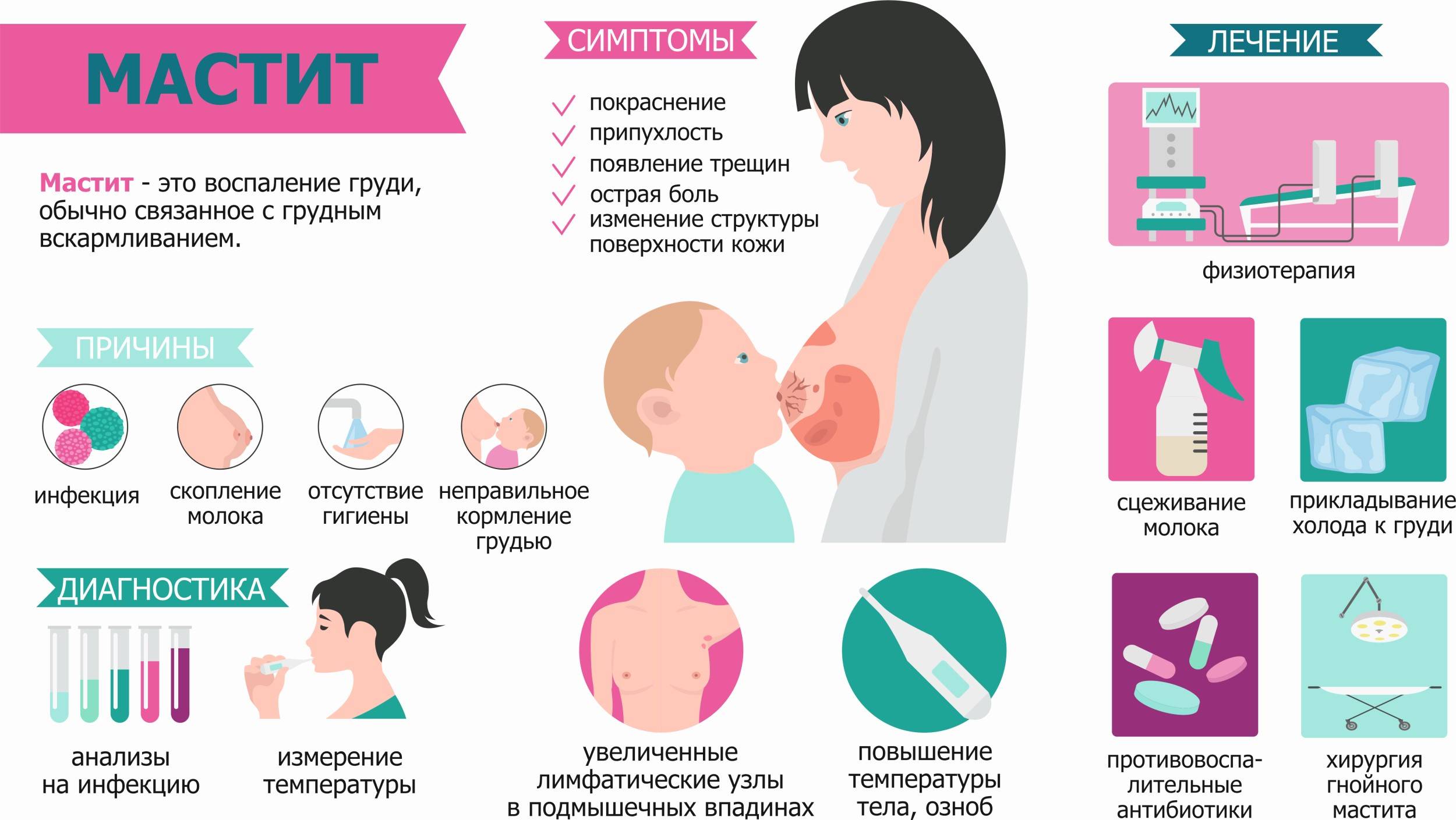 Лактостаз у кормящей матери: симптомы и лечение | уроки для мам