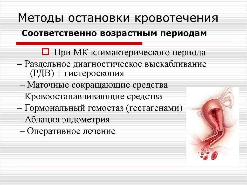Кровотечение при месячных, как остановить сильное кровотечение при месячных