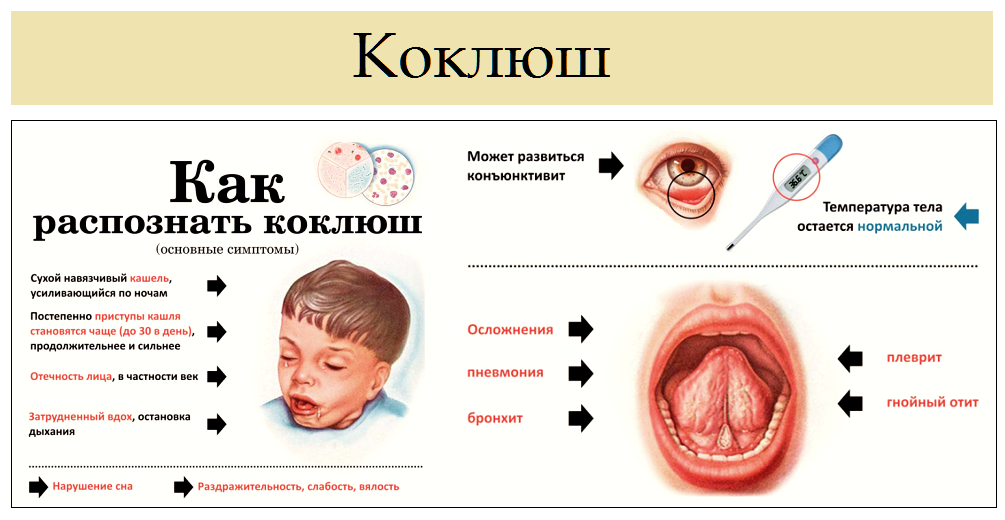Как лечить стоматит у грудничка и мамы