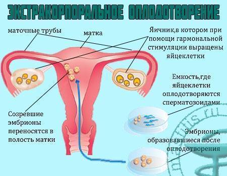 Как можно улучшить кровоток в матке при планировании беременности и перед переносом эмбрионов для эко?