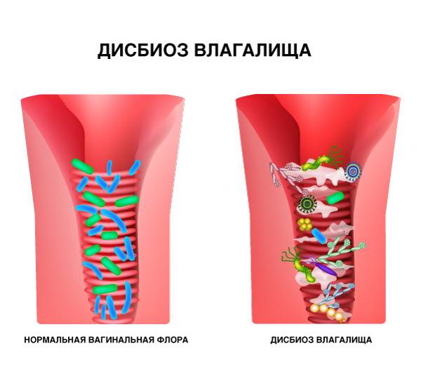 Сухая кожа интимной зоны