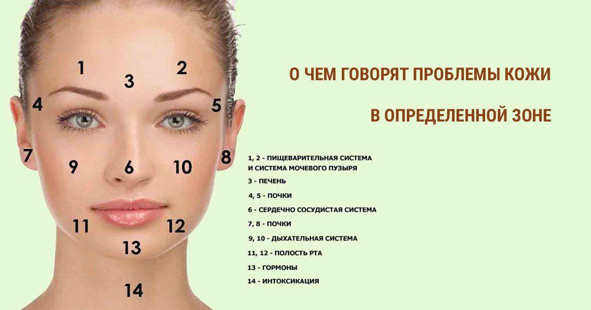 Причины возникновения внутренних прыщей на подбородке у женщин, девушек и мужчин: почему обсыпало и как появляются подкожные угри, какие есть симптомы их появления, лечение лица