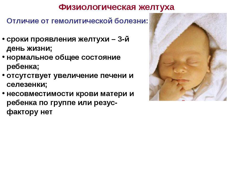 Желтуха у новорожденных: причины и последствия, степени, лечение | baikalstom.ru