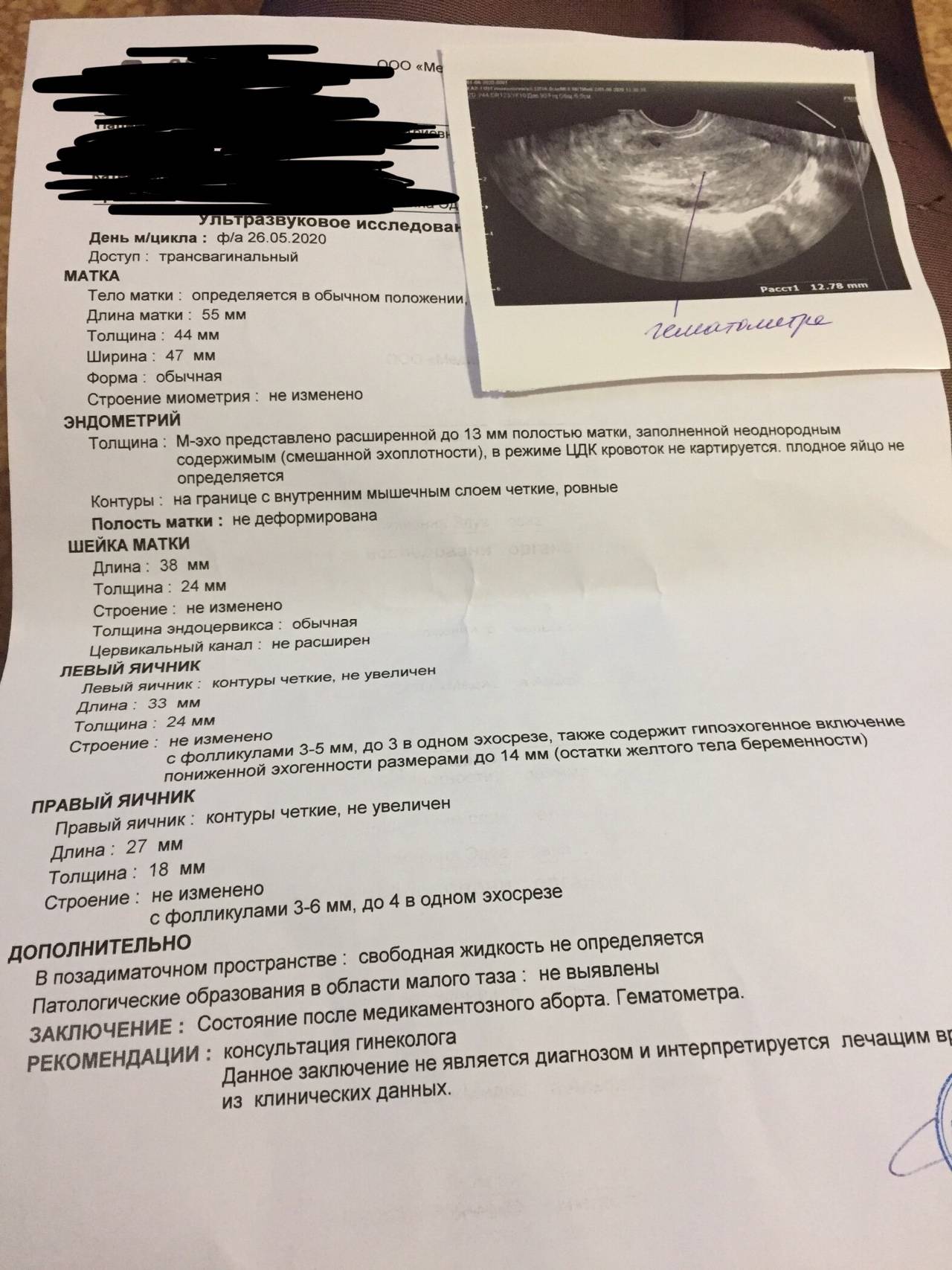 Плодное яйцо после медикаментозного аборта, ответы врачей, консультация