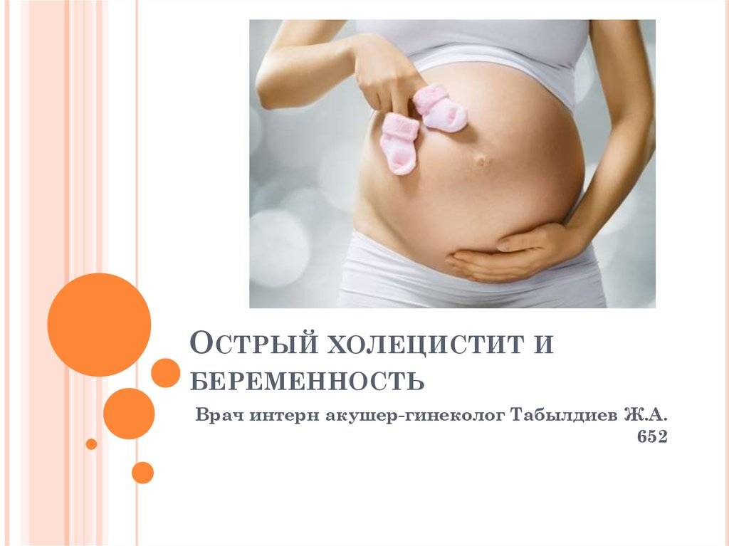 Холецистит при беременности: симптомы, лечение, влияние на плод