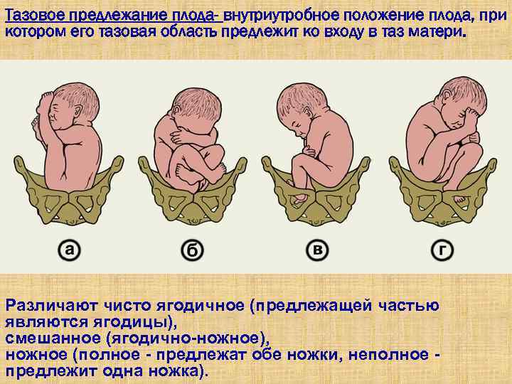 Как определяется положение плода при беременности