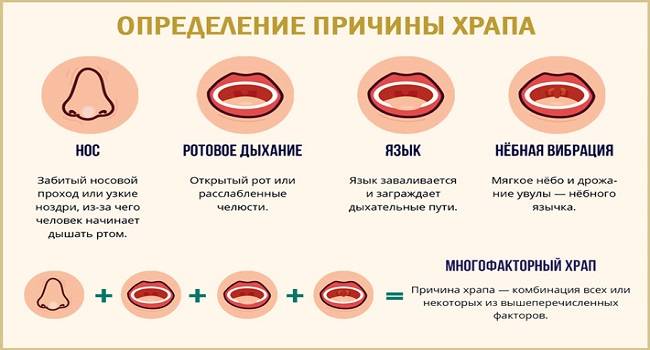 Храп у ребенка во сне — причины возникновения, отличие от сопения и диагностика — med-anketa.ru